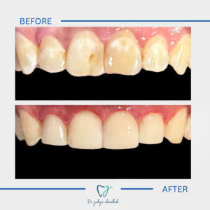 0C2106C9-608B-4BF1-B0F5-663BD5871467