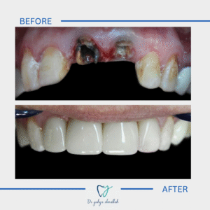 Copy of Beige Brown Neutral Before + After Instagram Post(2)