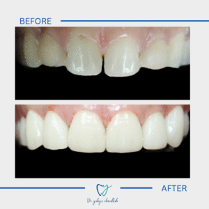 Copy of Beige Brown Neutral Before + After Instagram Post(3)