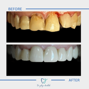 Copy of Beige Brown Neutral Before + After Instagram Post(4)