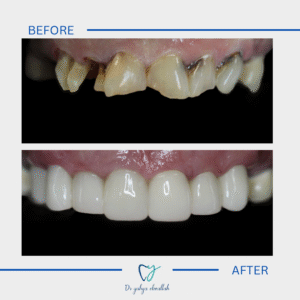 Copy of Beige Brown Neutral Before + After Instagram Post(5)