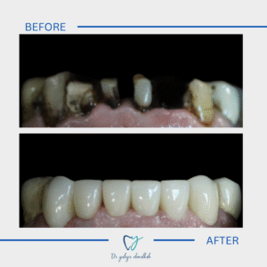 Copy of Beige Brown Neutral Before + After Instagram Post(7)