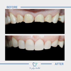 Copy of Beige Brown Neutral Before + After Instagram Post(8)