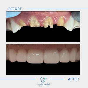 Copy of Beige Brown Neutral Before + After Instagram Post - 1